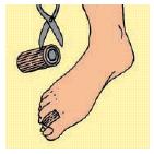 TUBOLARE CON GEL SU UN LATO 10CM DIGI-STRIP S - Farmacia Mortise
