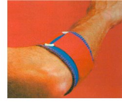 FASCIA THERMOSKIN PER EPICONDILITE CON PRESSORE SMALL INDICATA NEL TRATTAMENTO DEL GOMITO DEL TENNISTA - Farmacia Mortise